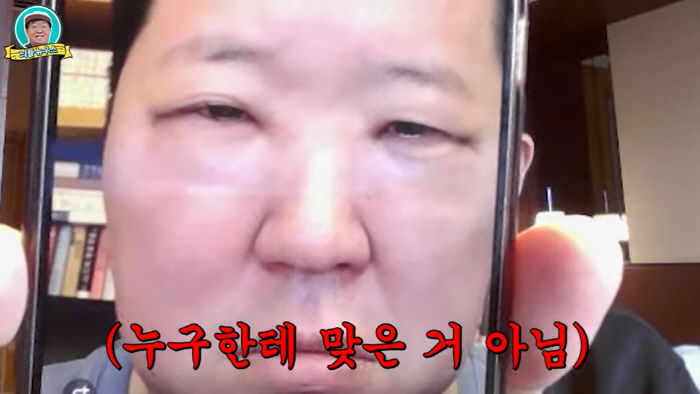 jung hyungdon cosmetic surgery