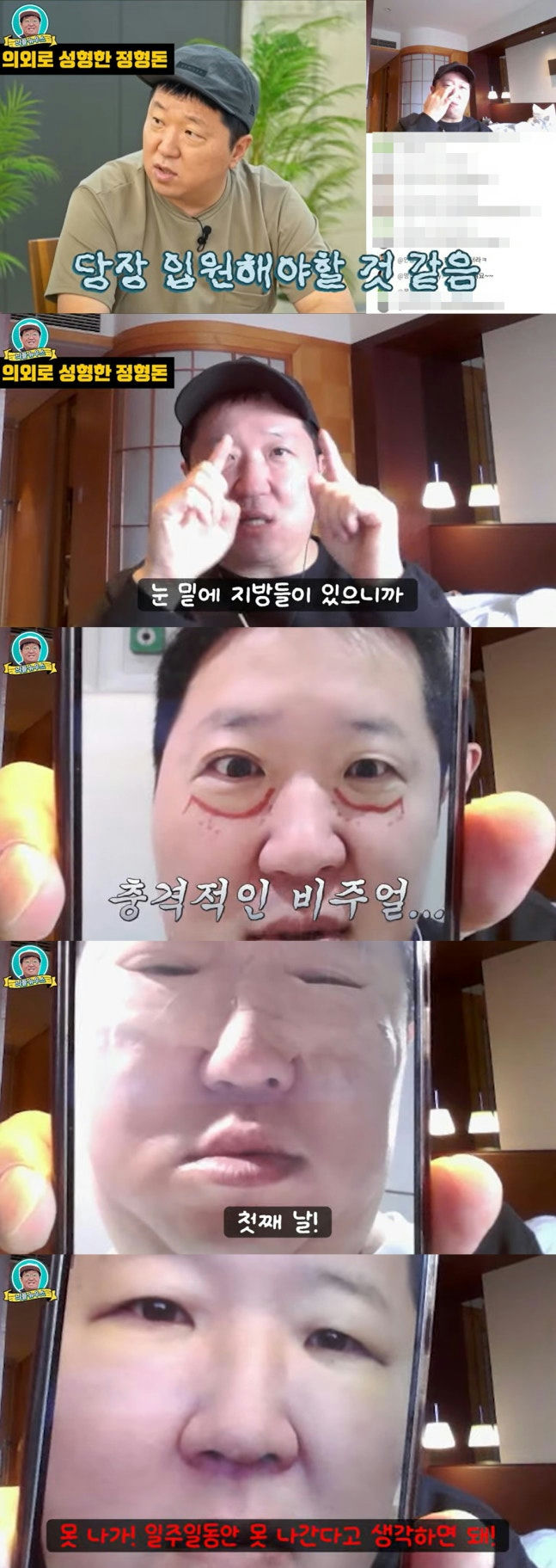 Jung Hyung-don cosmetic surgery