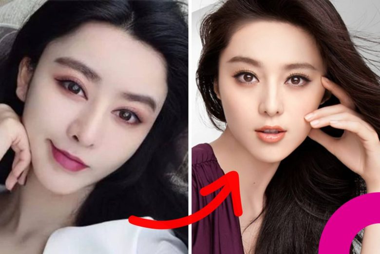 He Chengxi Fan Bingbing surgery