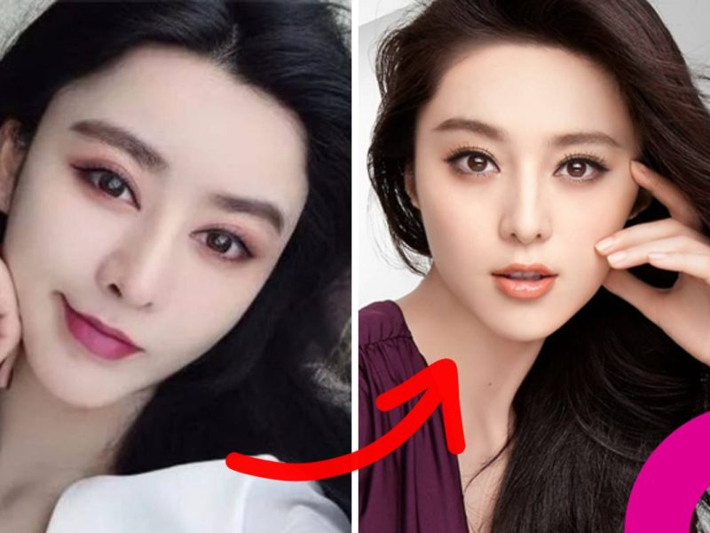 He Chengxi Fan Bingbing surgery