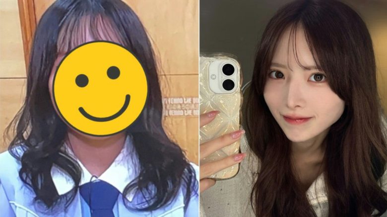 miyu sakaki plastic surgery transformation