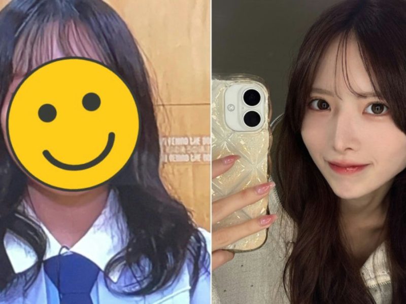 miyu sakaki plastic surgery transformation