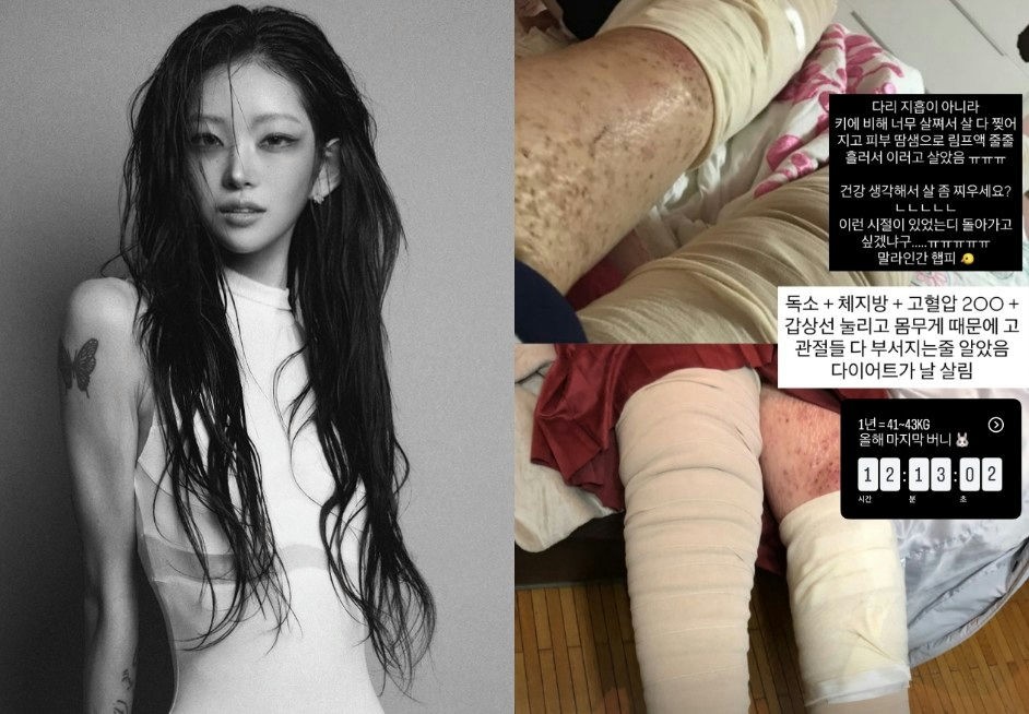 choi jun hee weight loss transformation