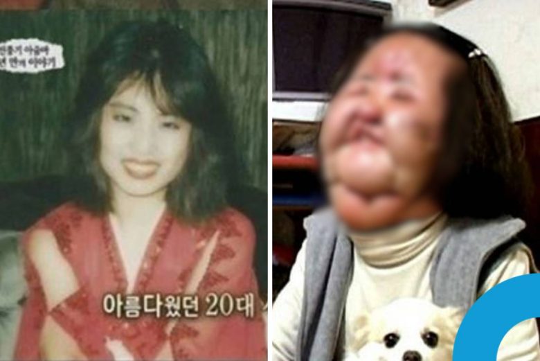 Han Mi Ok plastic surgery tragedy