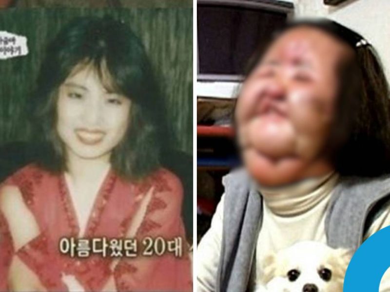 Han Mi Ok plastic surgery tragedy