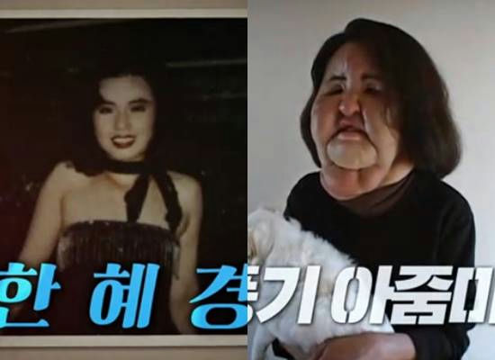 fan lady han hyekyung illegal cosmetic surgery