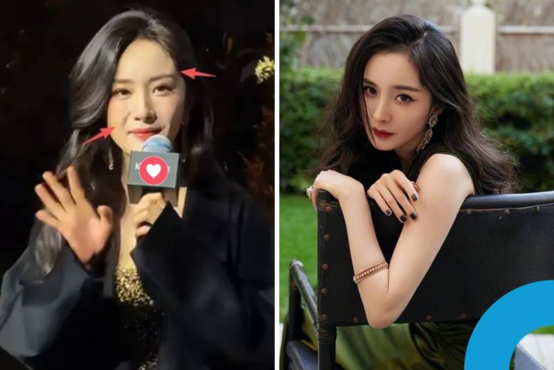 Yang Mi plastic surgery rumors