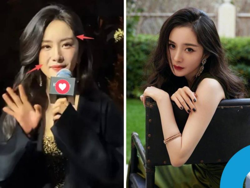 Yang Mi plastic surgery rumors