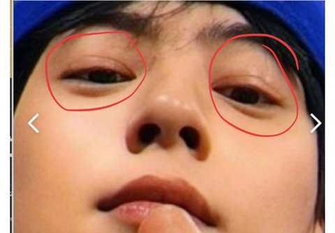 cha eun woo plastic surgery rumors of589apl8aimg3ahpuelhy8vgh1oaqhbr5lwdxvnqss-cha-eun-woo-plastic-surgery-rumors