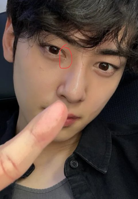 cha eun woo plastic surgery rumors abuoiwm-awcaygarf3ezhb23kxvxleeeogere-0msdo-cha-eun-woo-plastic-surgery-rumors