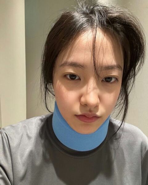 Red Velvet Yeri neck injury