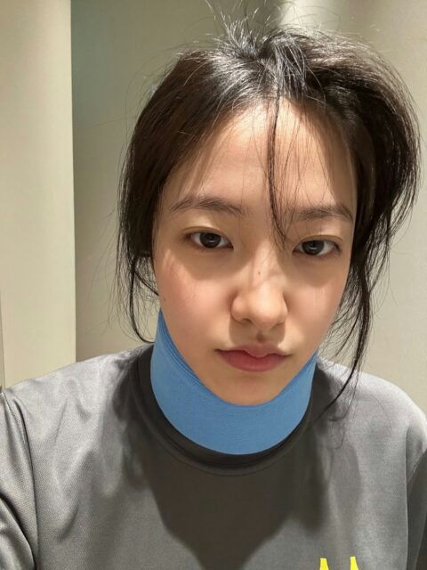 Red Velvet Yeri neck injury