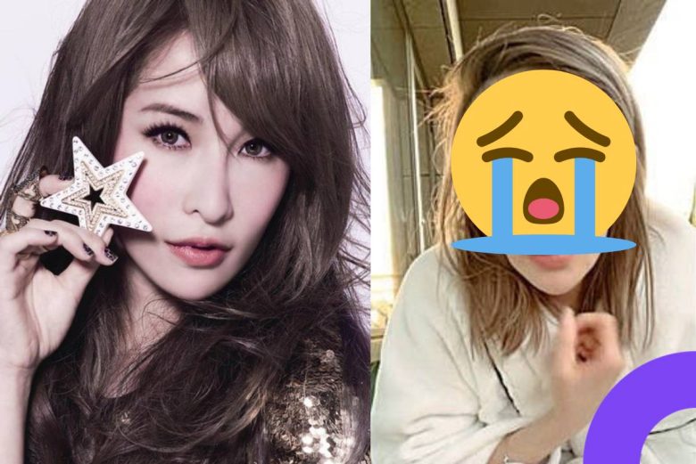 Elva Hsiao disfigured after dog attack