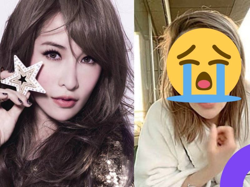 Elva Hsiao disfigured after dog attack