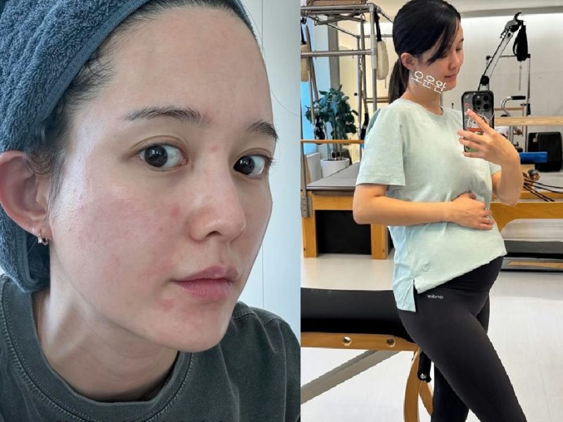 nam bo ra pregnancy skin changes
