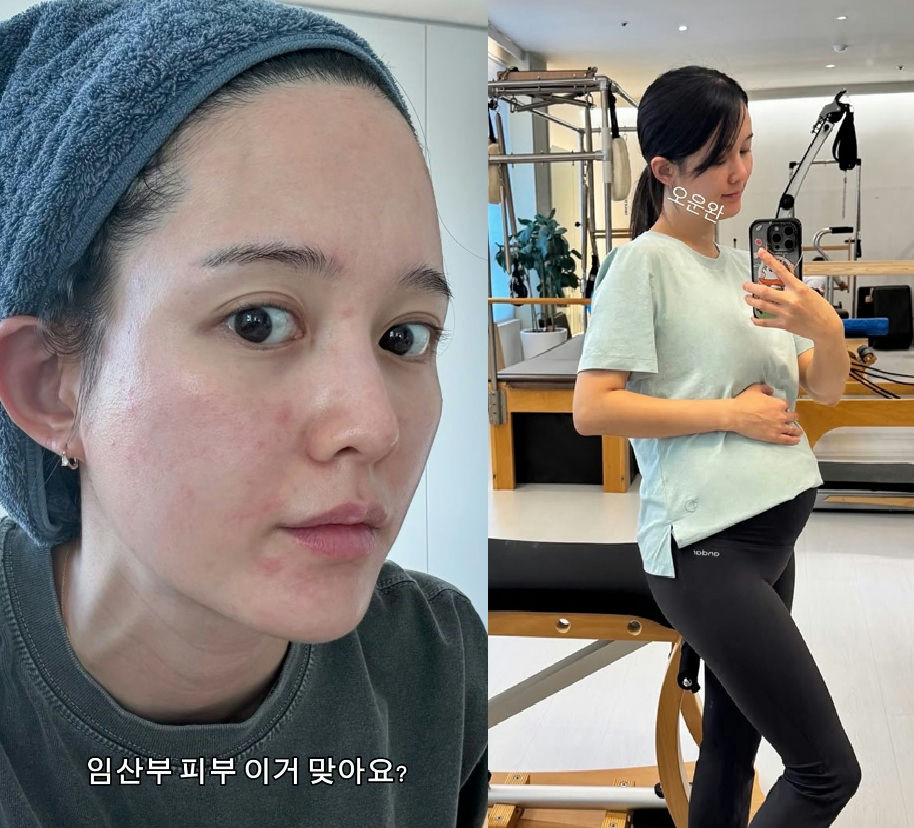 nam bo ra pregnancy skin changes