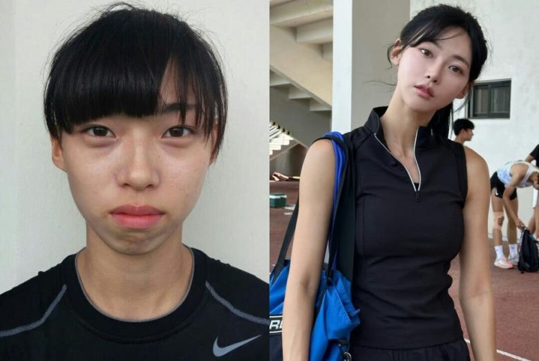 kim min gee plastic surgery rumors