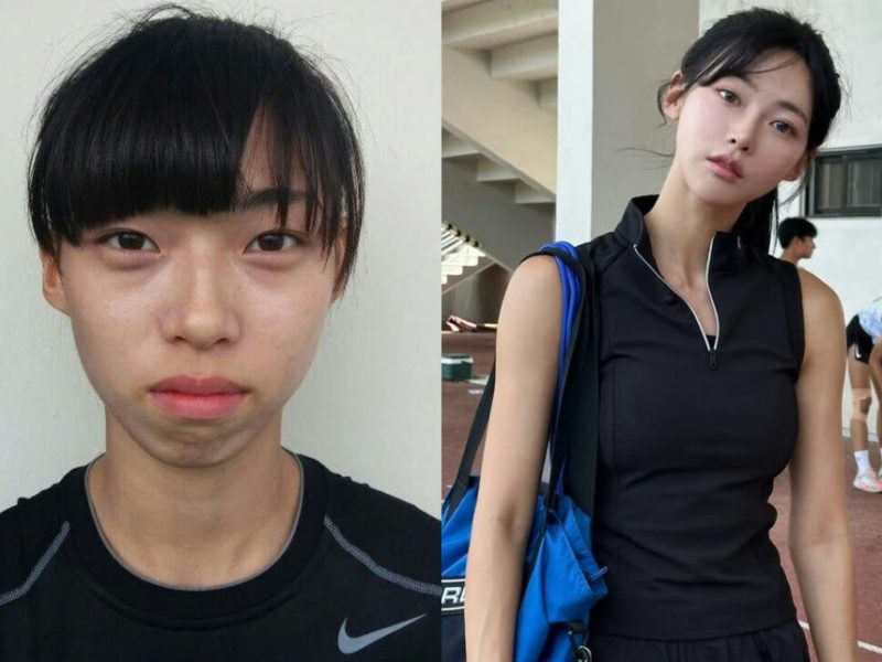 kim min gee plastic surgery rumors