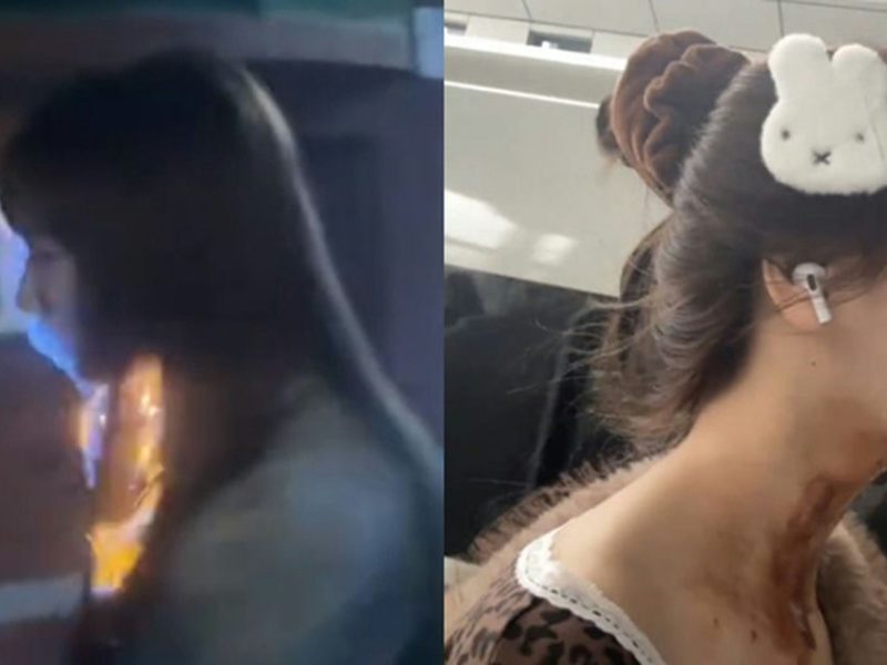 wang tianyu flaming cake accident
