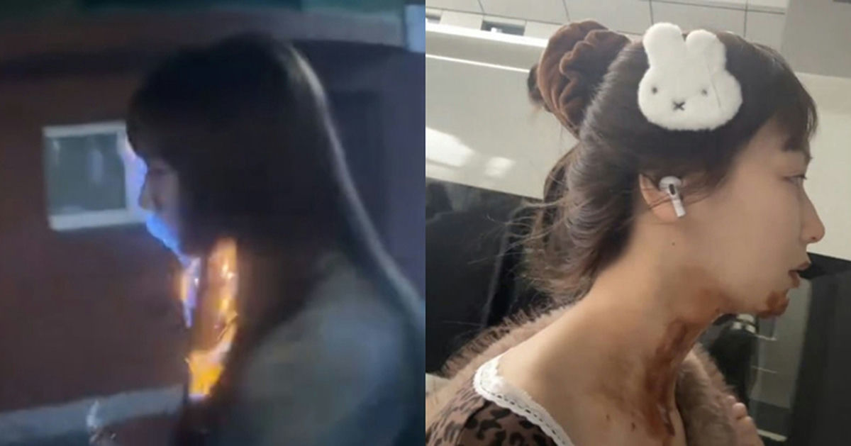 wang tianyu flaming cake accident