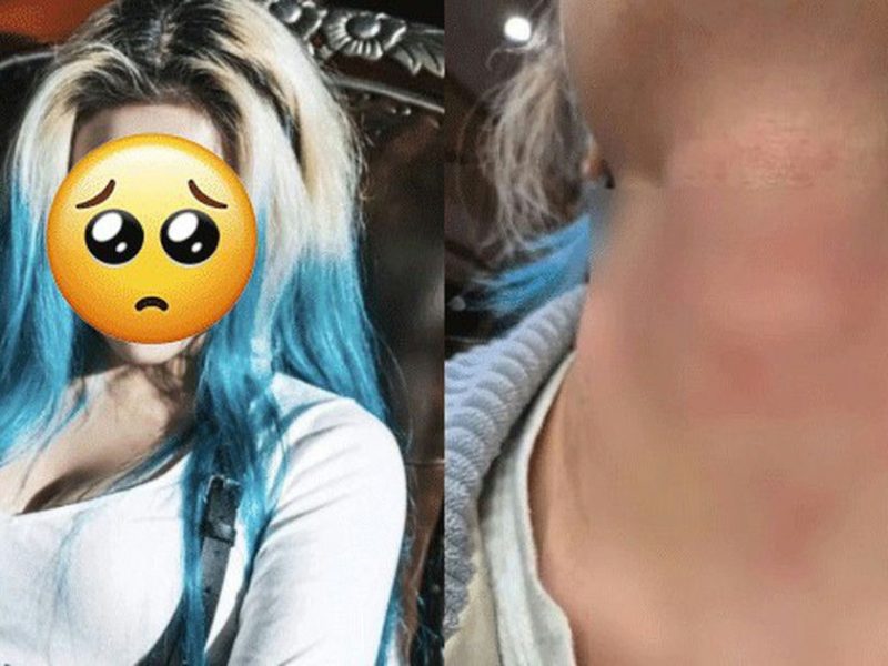 hyunjung assault controversy