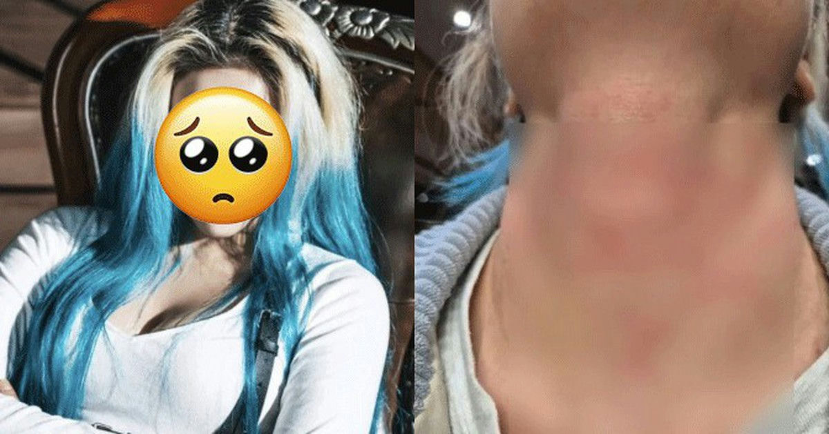 hyunjung assault controversy
