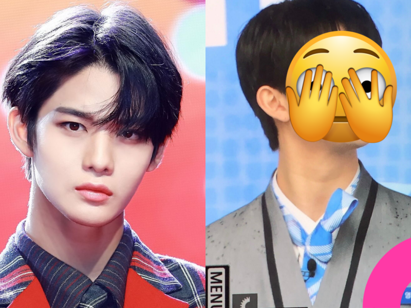 bae jinyoung plastic surgery controversy