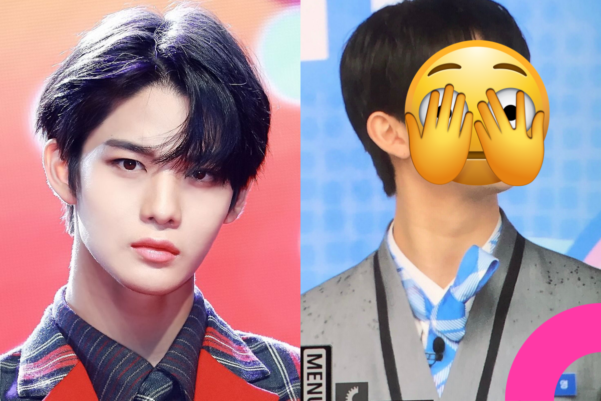 bae jinyoung plastic surgery controversy