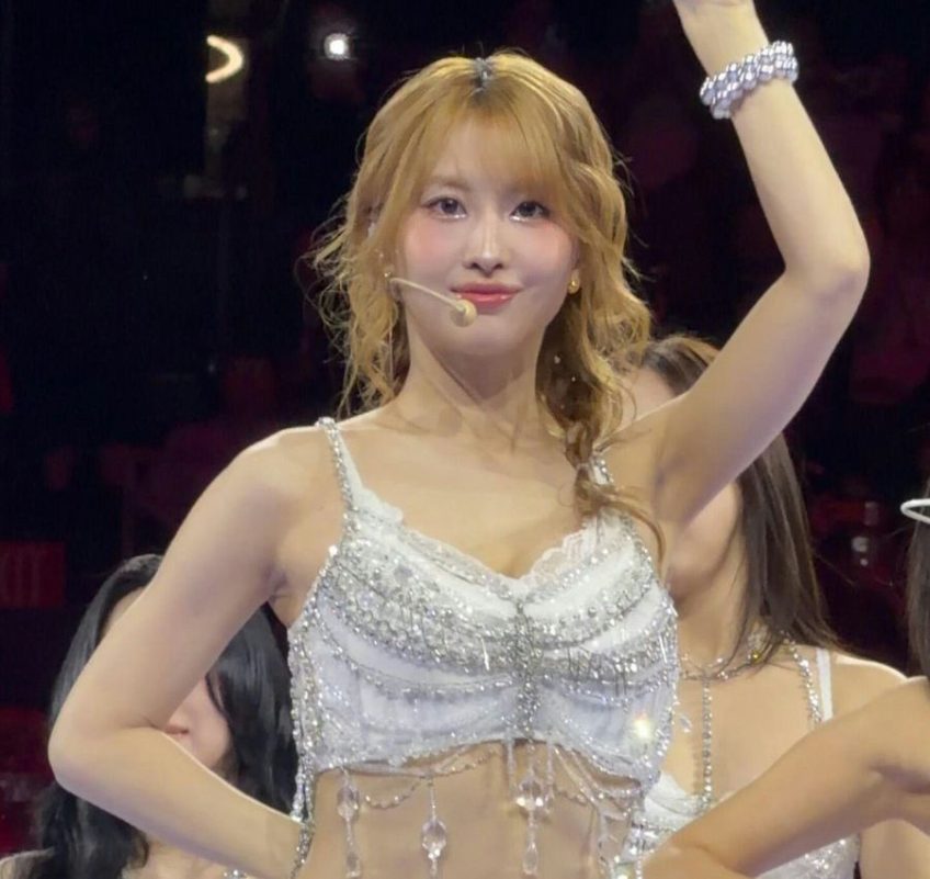 TWICE’s Momo Forced to Extract Tooth During World Tour, Sparking Health Concerns