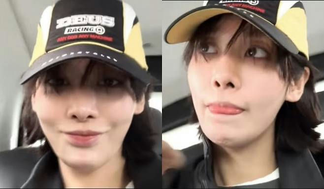 Cha Joo Young health update surgery