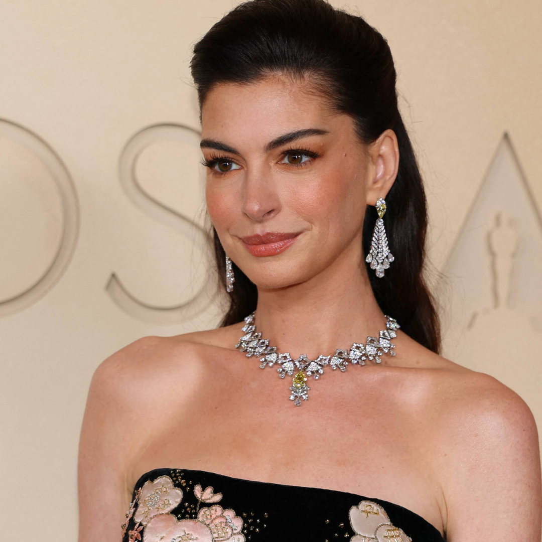 anne hathaway legally blind left eye