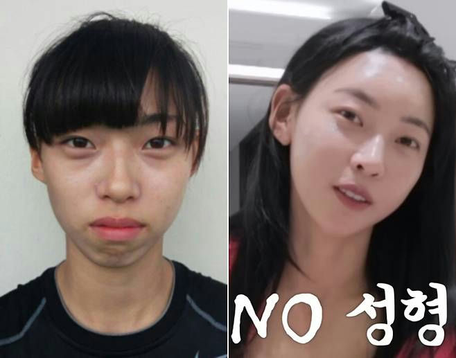 kim min gee plastic surgery rumors