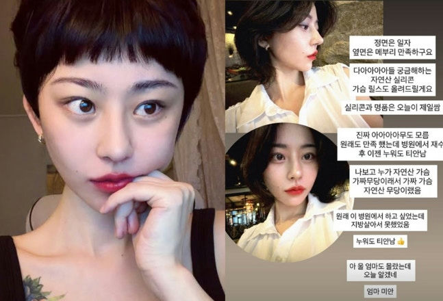 Noh Seul Bi breast surgery
