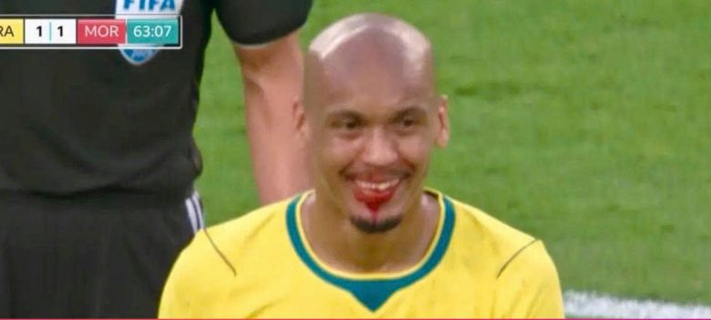 fabinho vampire smile world cup 2026