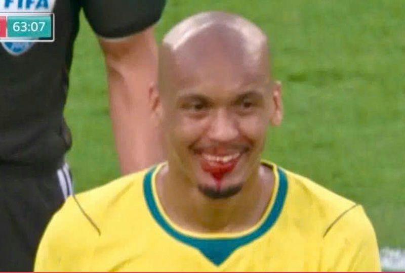 fabinho vampire smile world cup 2026