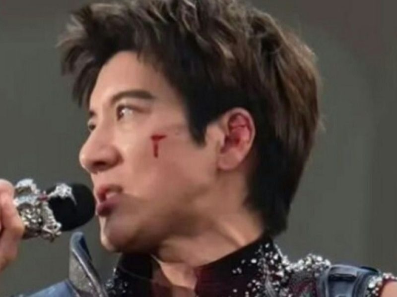 Leehom Wang Injured in Concert Fall, Receives 39 Stitches After Stage Accident
