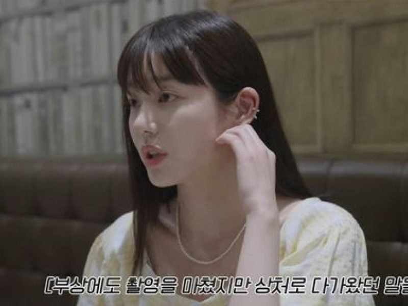 lee yoo bi acting criticism
