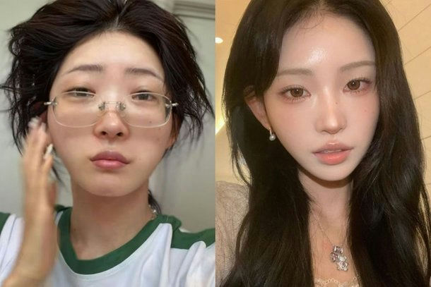 choi jun hee lip fillers