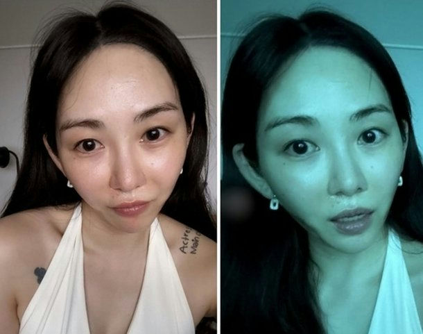 kwon mina medical procedure accident